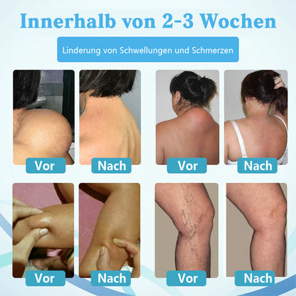 NEGUSY™ LumpsClear Lymph - Sag Lebewohl zu Lipomen und Schwellungen