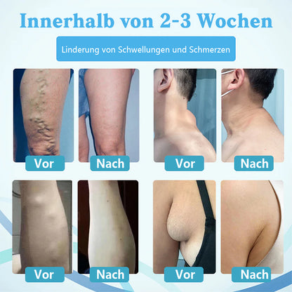 NEGUSY™ LumpsClear Lymph - Sag Lebewohl zu Lipomen und Schwellungen