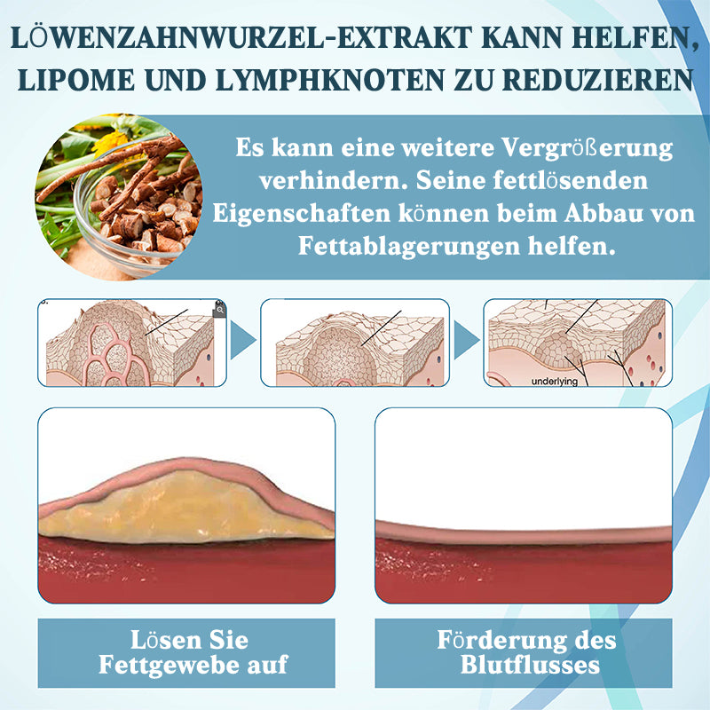 NEGUSY™ LumpsClear Lymph - Sag Lebewohl zu Lipomen und Schwellungen