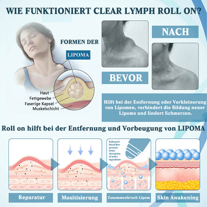 NEGUSY™ LumpsClear Lymph - Sag Lebewohl zu Lipomen und Schwellungen