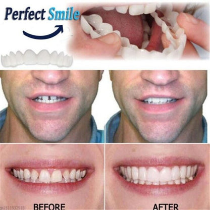 Latest👨‍⚕Adjustable Snap-On Dentures😁 (💥50% OFF) - 🔥HOT SALE🔥🎉